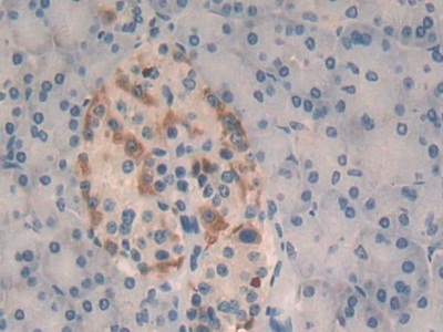 Polyclonal Antibody to Persephin (PSPN)