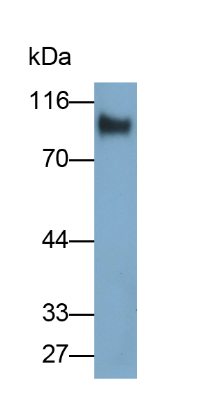 Polyclonal Antibody to Tropomyosin Receptor Kinase B (TrkB)