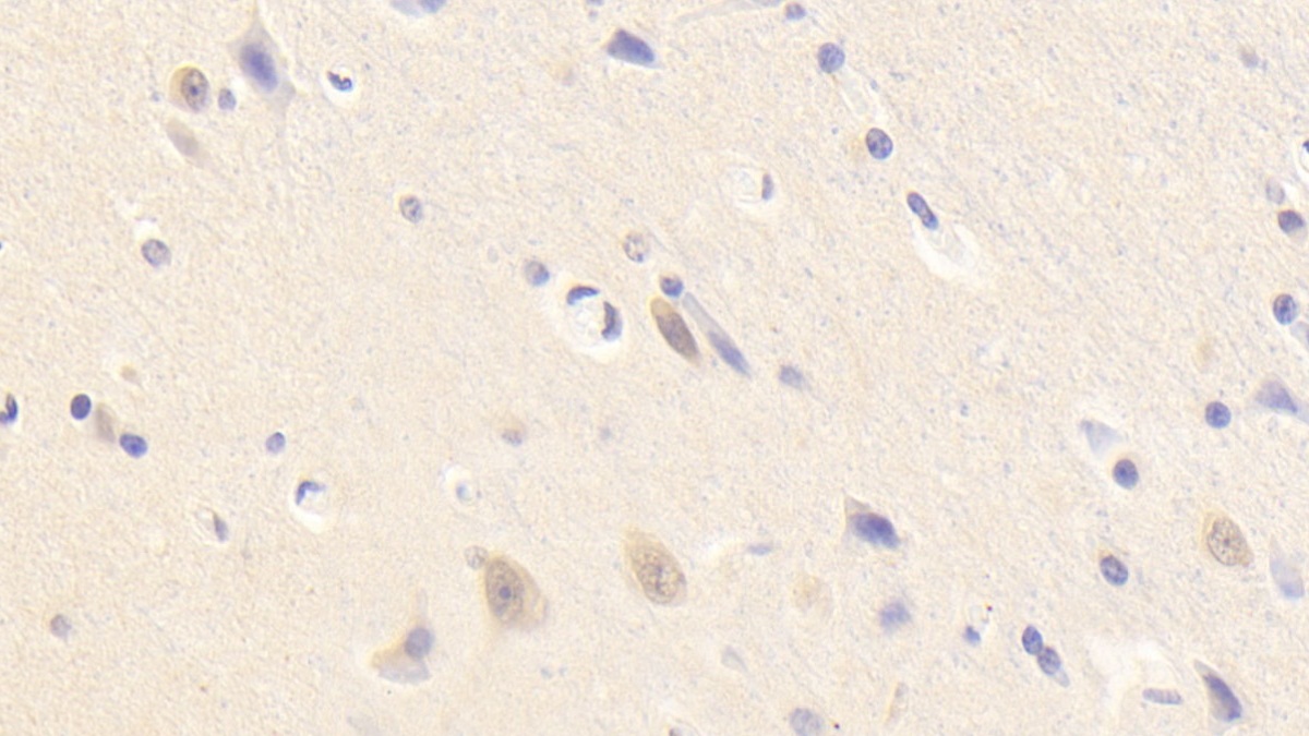 Polyclonal Antibody to Neurotrophic Tyrosine Kinase Receptor Type 3 (NTRK3)