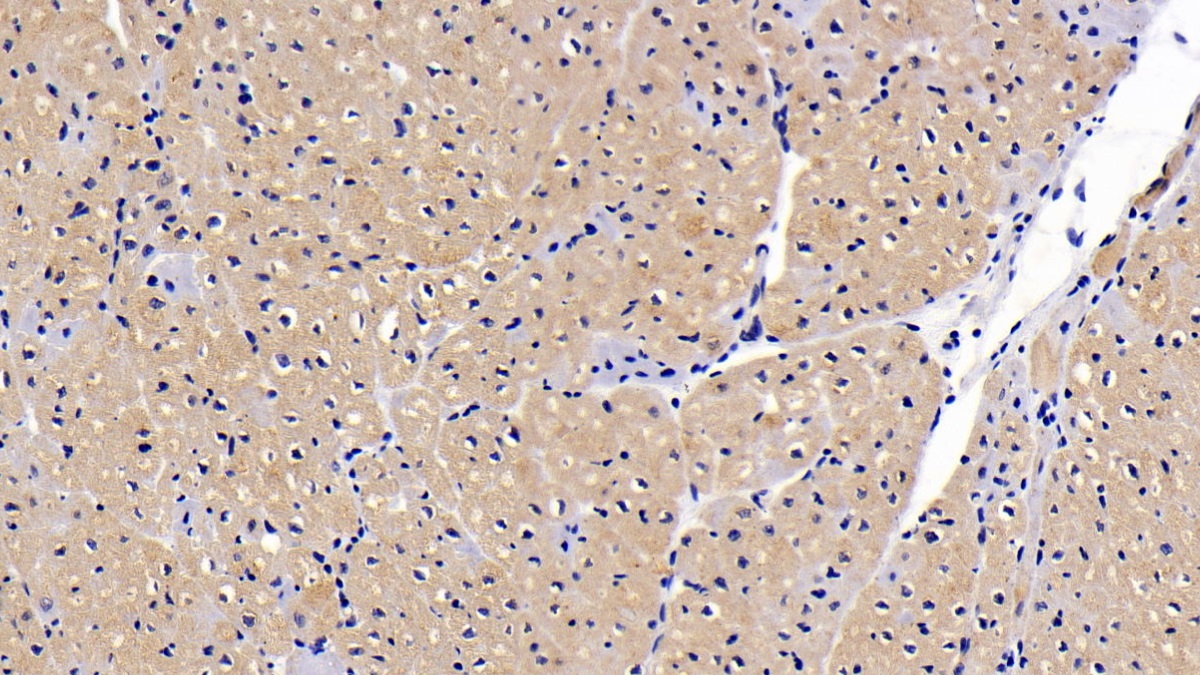 Polyclonal Antibody to Ciliary Neurotrophic Factor Receptor (CNTFR)