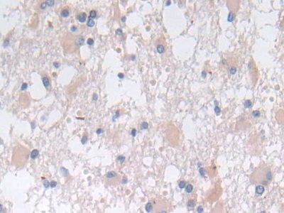 Polyclonal Antibody to Sorting Nexin 13 (SNX13)