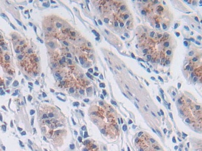 Polyclonal Antibody to Sorting Nexin 13 (SNX13)