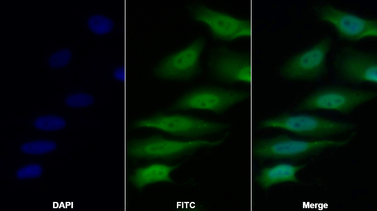 Polyclonal Antibody to Histone Deacetylase 1 (HDAC1)