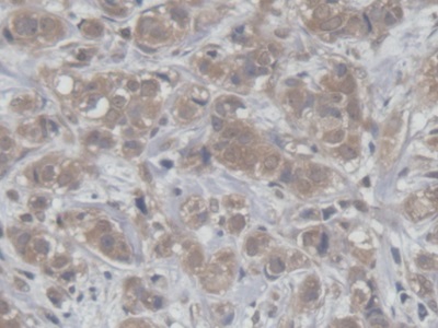 Polyclonal Antibody to Host Cell Factor C1 (HCFC1)