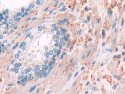 Polyclonal Antibody to Filamin A Alpha (FLNa)