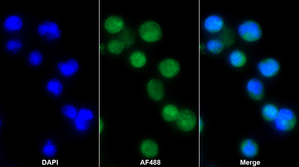 Polyclonal Antibody to Lymphoid Enhancer Binding Factor 1 (LEF1)