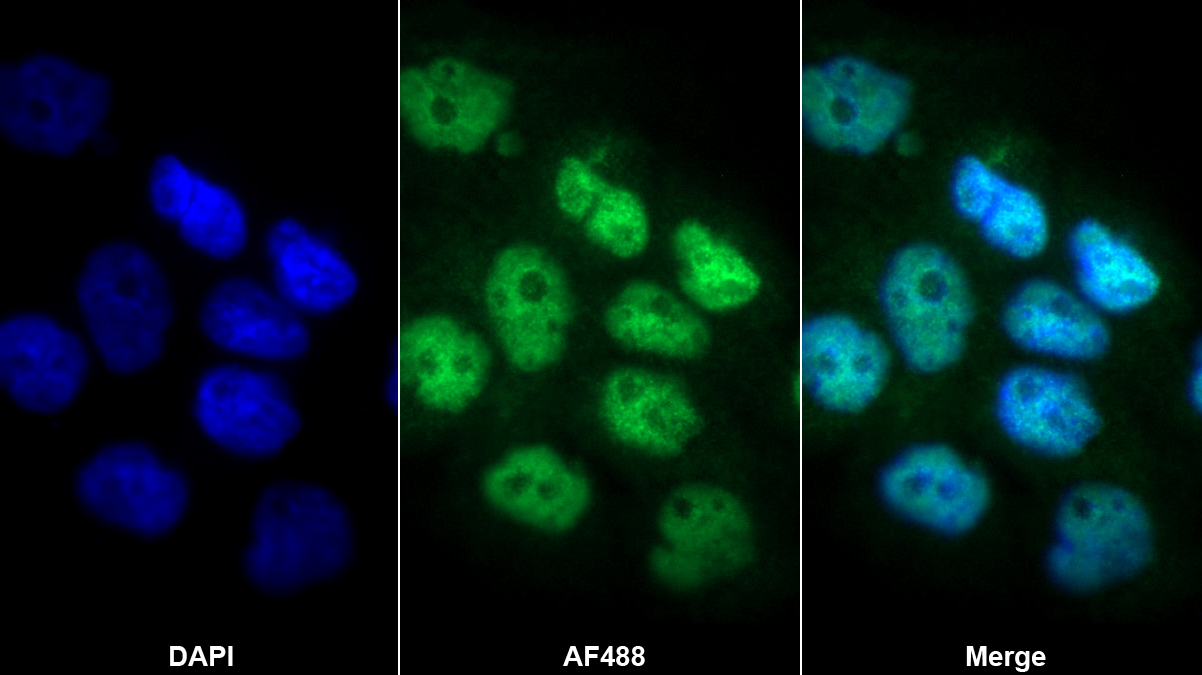 Polyclonal Antibody to E1A Binding Protein P300 (EP300)