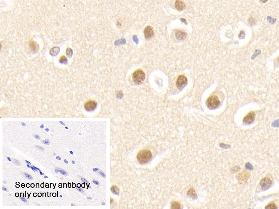 Polyclonal Antibody to Amyloid Beta Precursor Protein Binding Protein 1 (APPBP1)