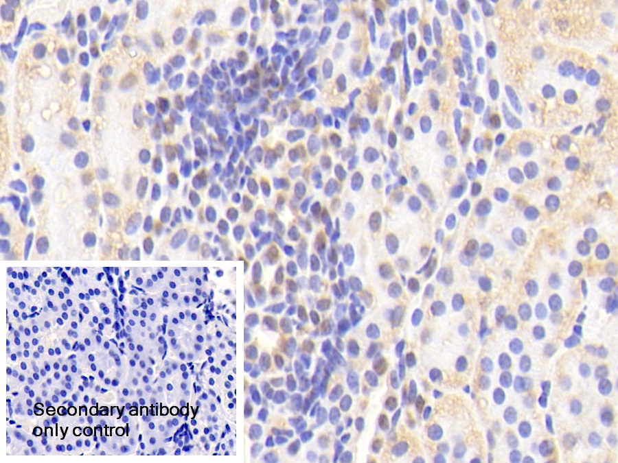 Polyclonal Antibody to Amyloid Beta Precursor Protein Binding Protein 1 (APPBP1)