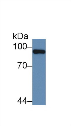 Polyclonal Antibody to Promyelocytic Leukemia Protein (PML)