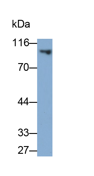 Polyclonal Antibody to Promyelocytic Leukemia Protein (PML)