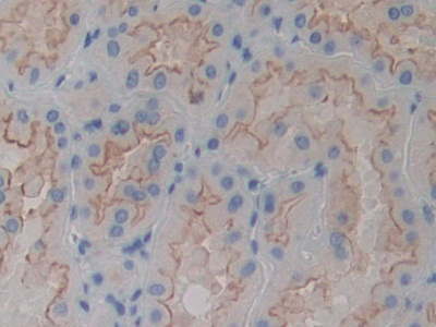 Polyclonal Antibody to Actinin Alpha 4 (ACTN4)