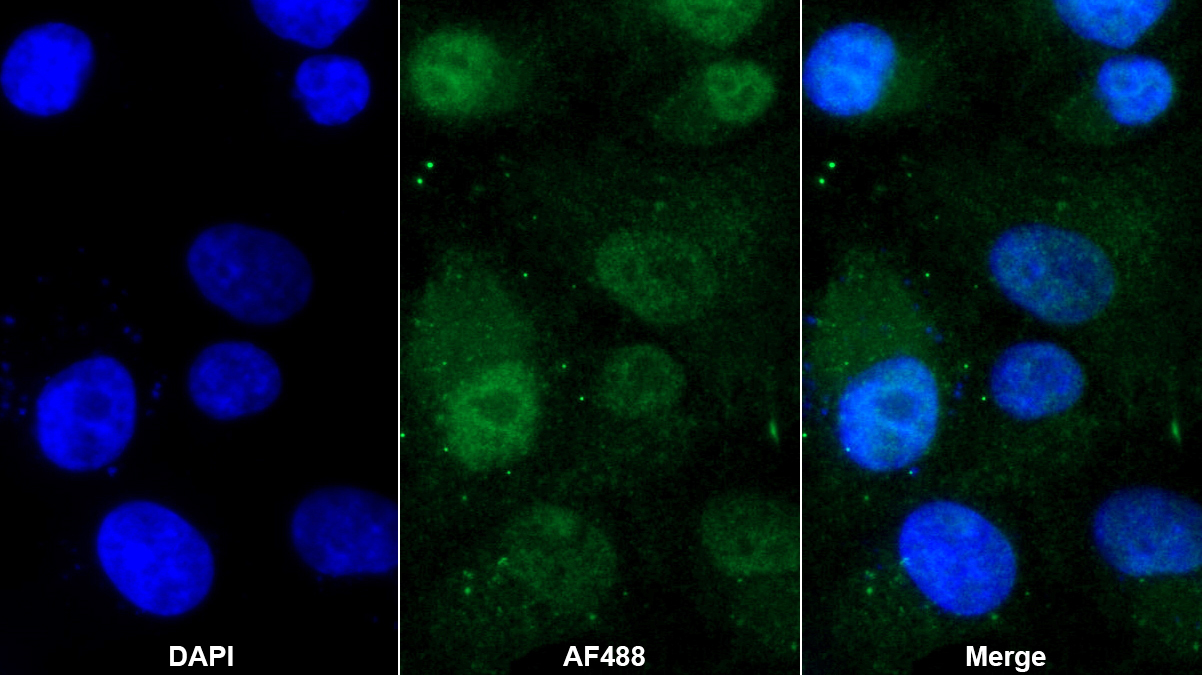 Polyclonal Antibody to Actinin Alpha 4 (ACTN4)