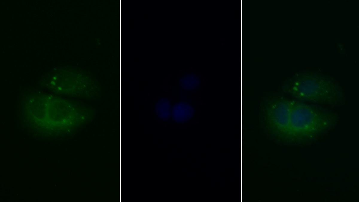 Polyclonal Antibody to Protein Kinase B Alpha (PKBa)