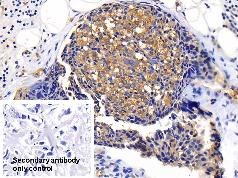 Polyclonal Antibody to Protein Kinase B Alpha (PKBa)