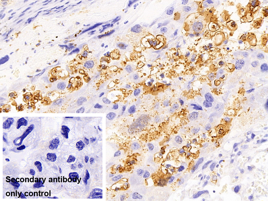 Polyclonal Antibody to Zyxin (ZYX)