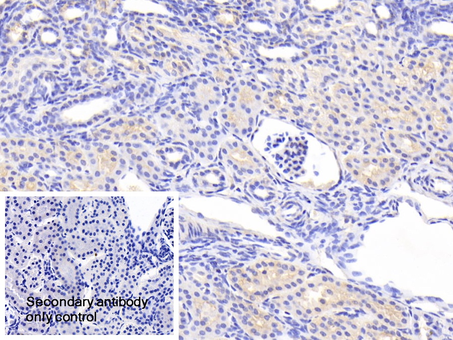 Polyclonal Antibody to Actinin Alpha 1 (ACTN1)