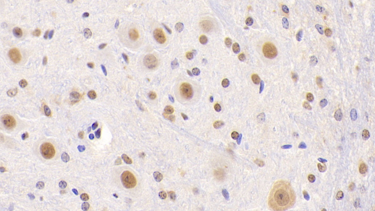 Polyclonal Antibody to Nucleolin (NCL)