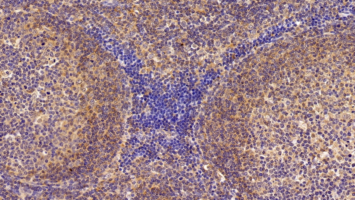 Polyclonal Antibody to Exportin 1 (XPO1)