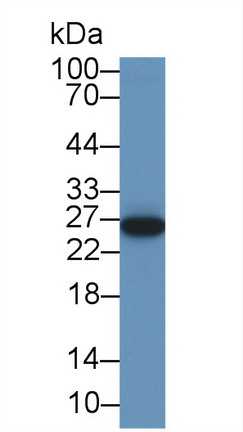 Polyclonal Antibody to Nuclear Receptor Subfamily 0,Group B,Member 2 (NR0B2)