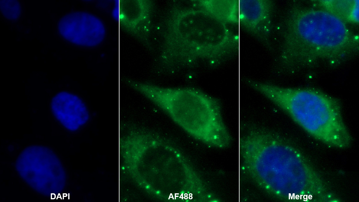 Polyclonal Antibody to Aminoadipate Semialdehyde Phosphopantetheinyl Transferase (AASDHPPT)