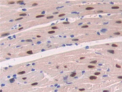 Polyclonal Antibody to Adenosine Kinase (ADK)