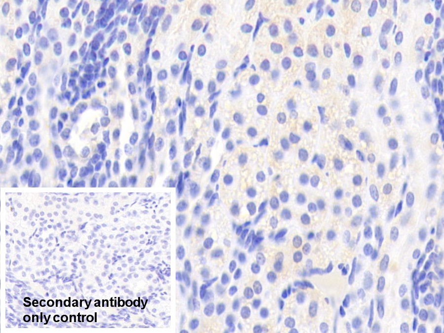 Polyclonal Antibody to Afamin (AFM)