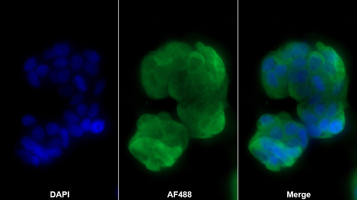 Polyclonal Antibody to Anterior Gradient 2 (AGR2)