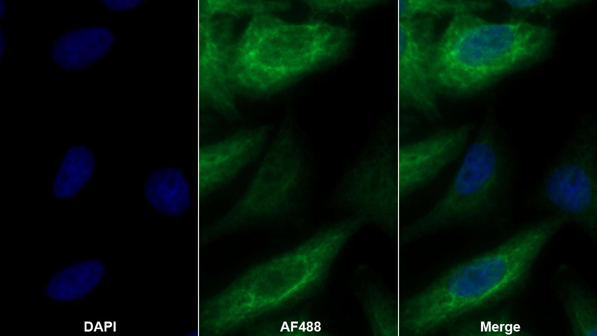 Polyclonal Antibody to Alanine Glyoxylate Aminotransferase (AGXT)