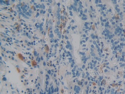 Polyclonal Antibody to Allograft inflammatory factor 1 (AIF1)