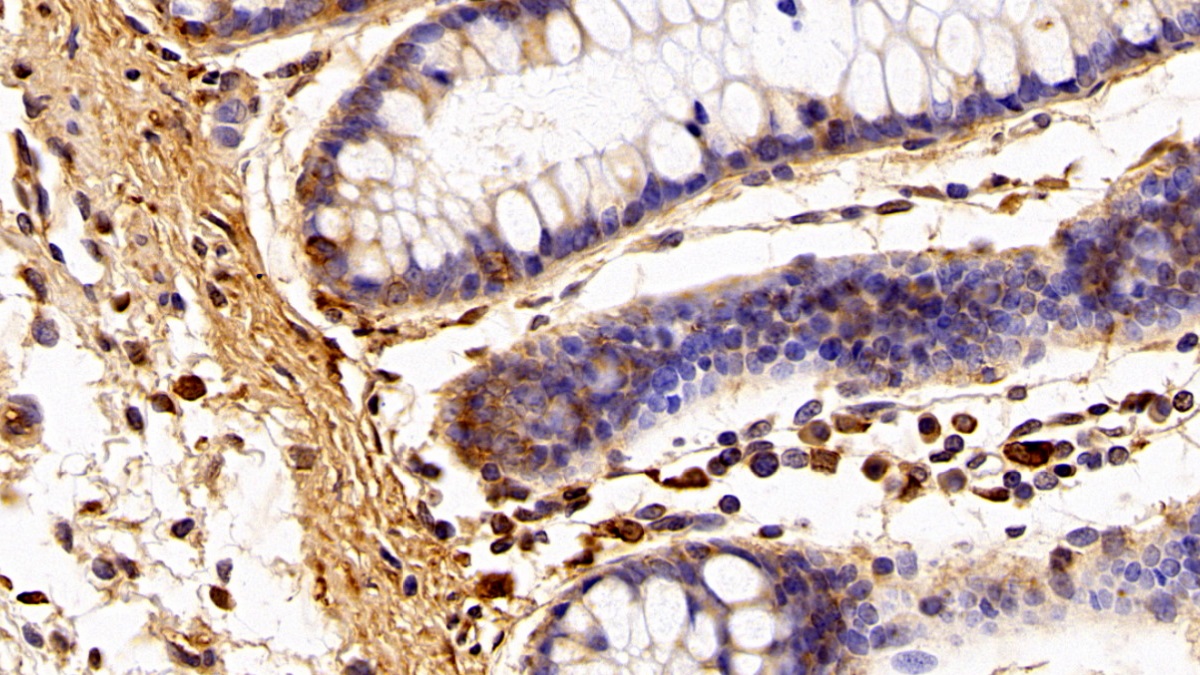 Polyclonal Antibody to Allograft inflammatory factor 1 (AIF1)