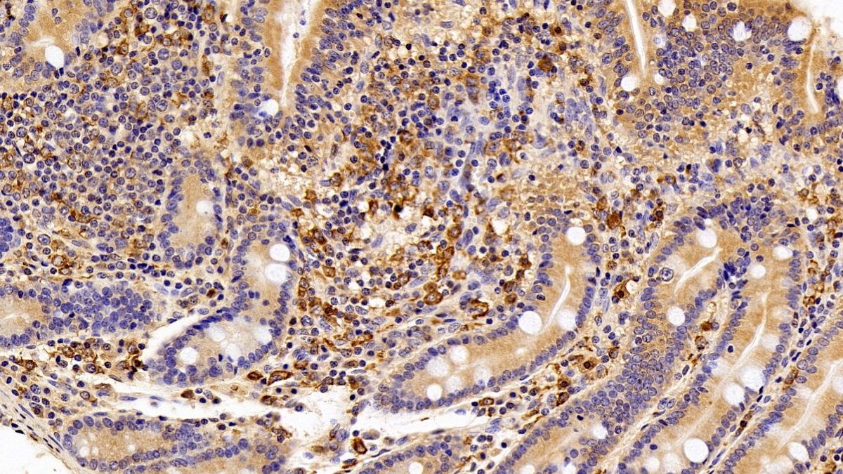Polyclonal Antibody to Allograft inflammatory factor 1 (AIF1)