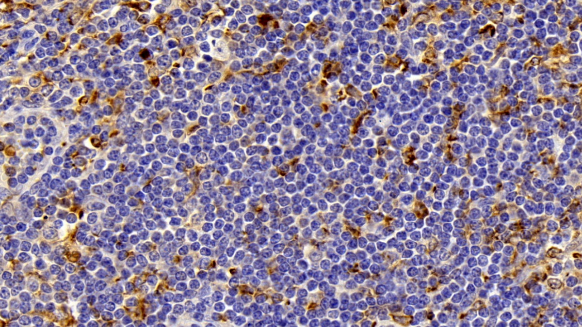 Polyclonal Antibody to Allograft inflammatory factor 1 (AIF1)