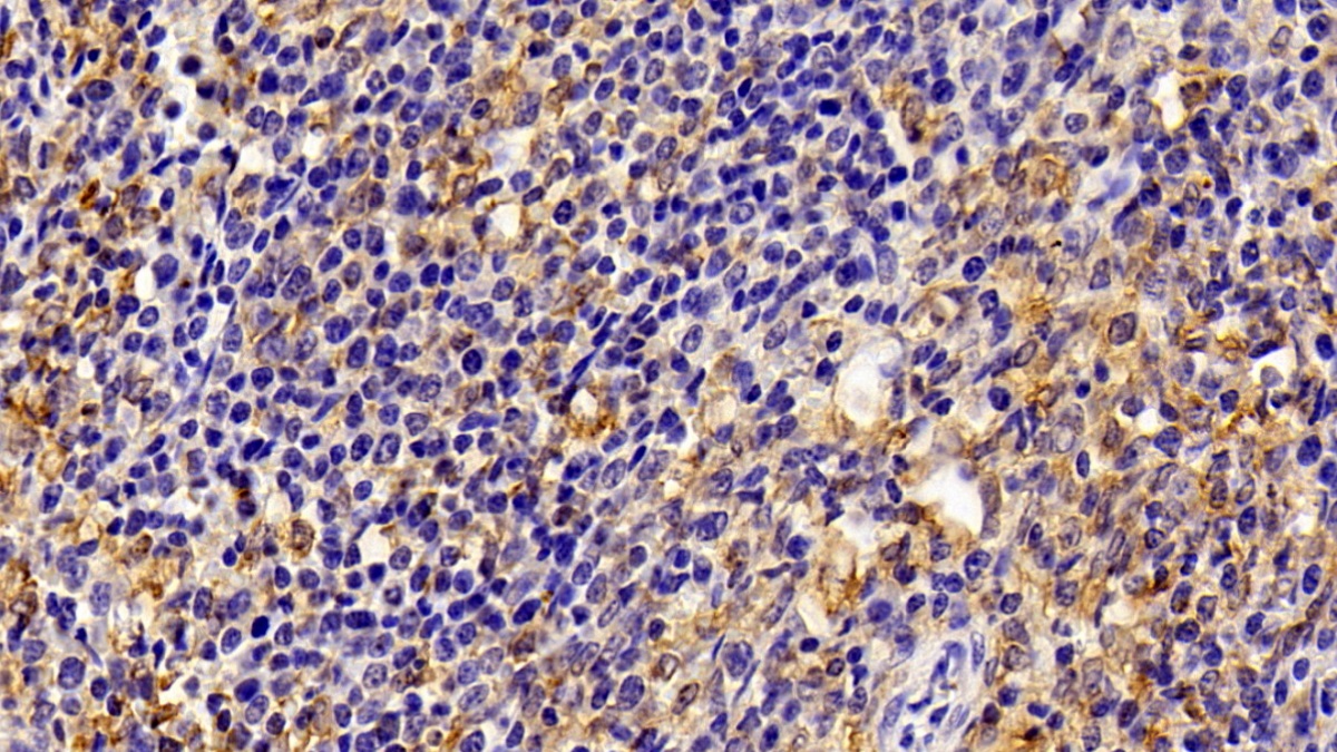 Polyclonal Antibody to Allograft inflammatory factor 1 (AIF1)