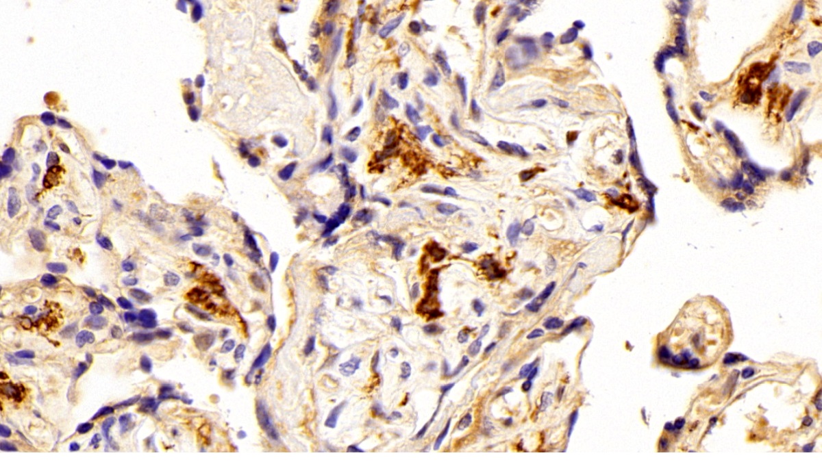 Polyclonal Antibody to Allograft inflammatory factor 1 (AIF1)