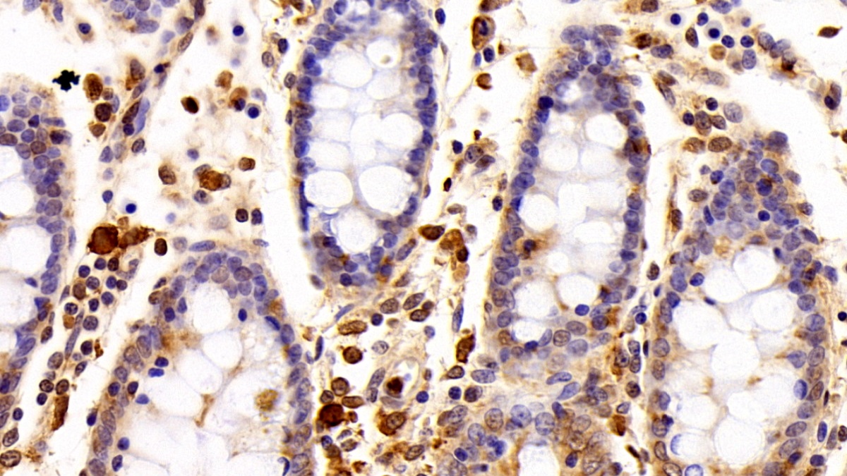 Polyclonal Antibody to Allograft inflammatory factor 1 (AIF1)