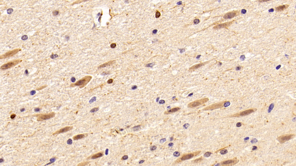 Polyclonal Antibody to Allograft inflammatory factor 1 (AIF1)