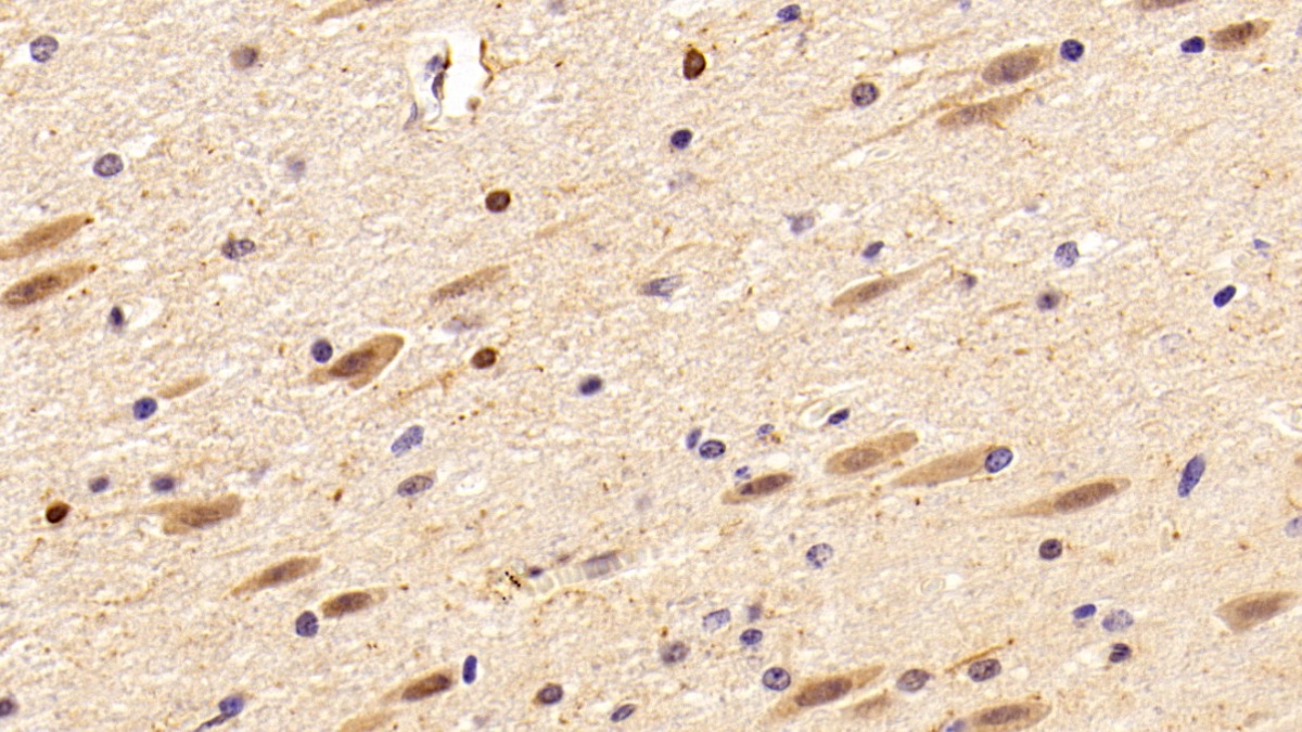 Polyclonal Antibody to Ionized Calcium-binding Adapter Molecule 1 (IBA1)