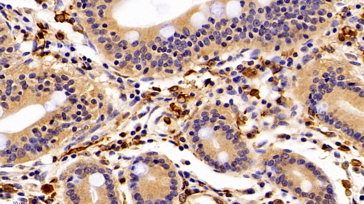 Polyclonal Antibody to Allograft inflammatory factor 1 (AIF1)