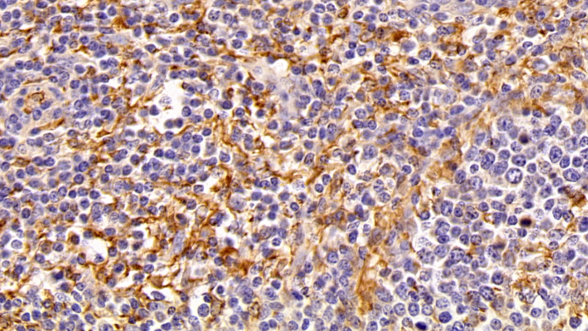 Polyclonal Antibody to Allograft inflammatory factor 1 (AIF1)