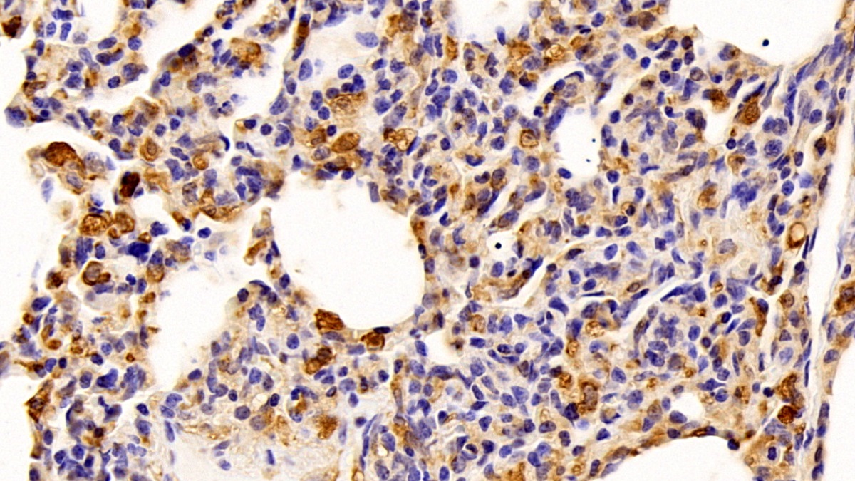Polyclonal Antibody to Allograft inflammatory factor 1 (AIF1)