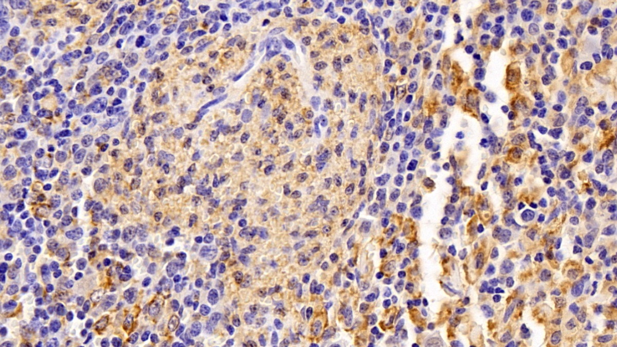 Polyclonal Antibody to Allograft inflammatory factor 1 (AIF1)