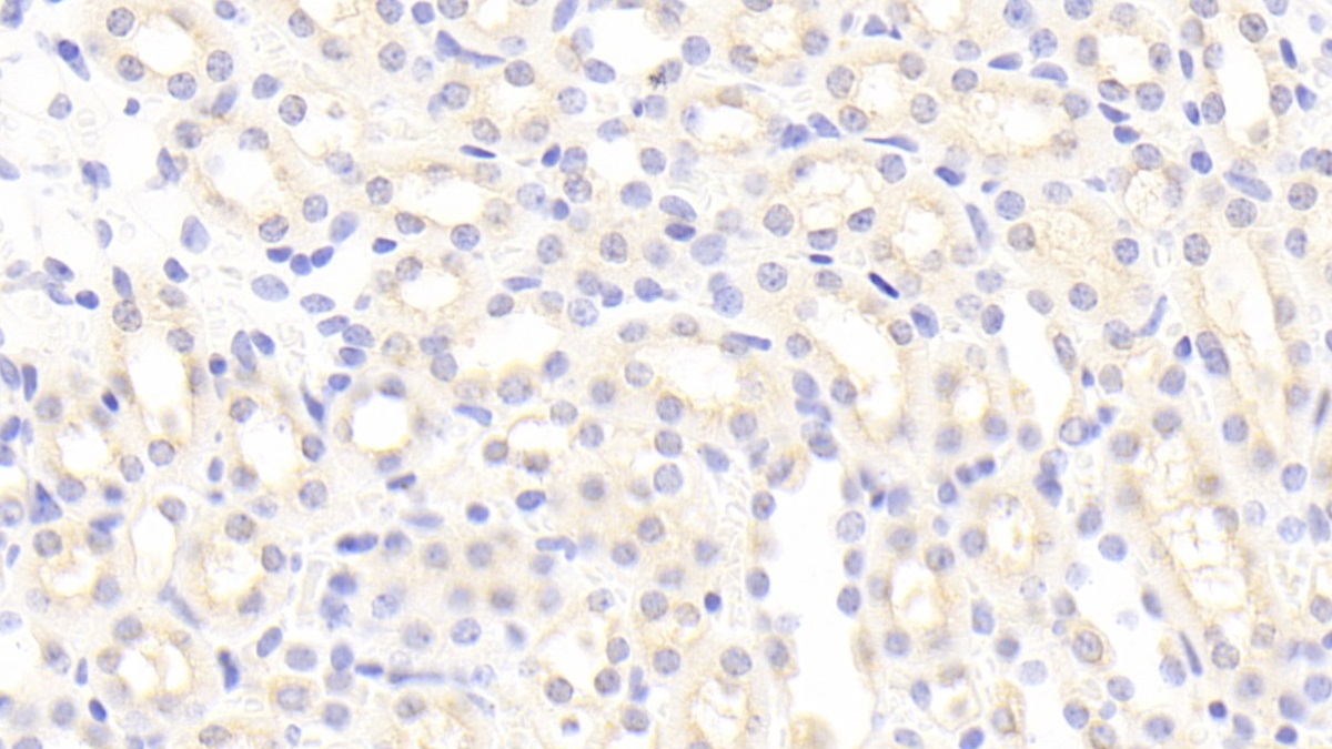 Polyclonal Antibody to Allograft inflammatory factor 1 (AIF1)