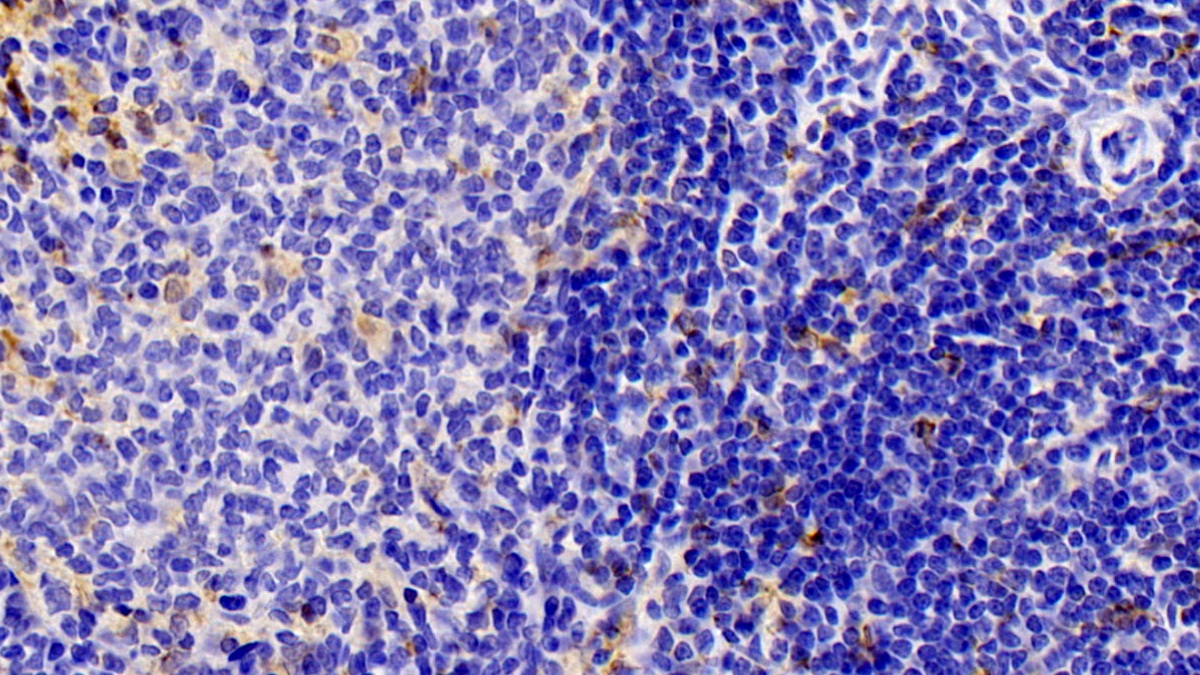 Polyclonal Antibody to Allograft inflammatory factor 1 (AIF1)