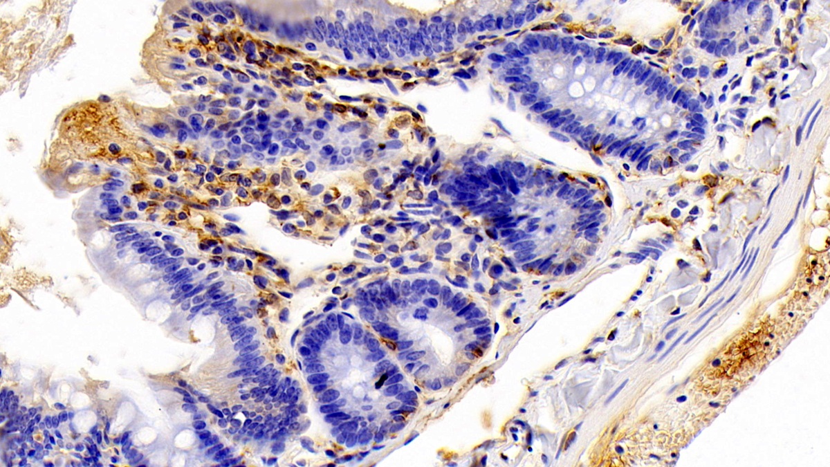 Polyclonal Antibody to Allograft inflammatory factor 1 (AIF1)