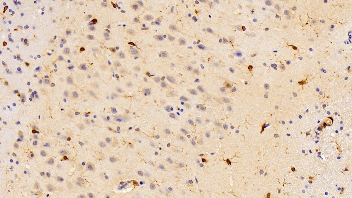 Polyclonal Antibody to Allograft inflammatory factor 1 (AIF1)