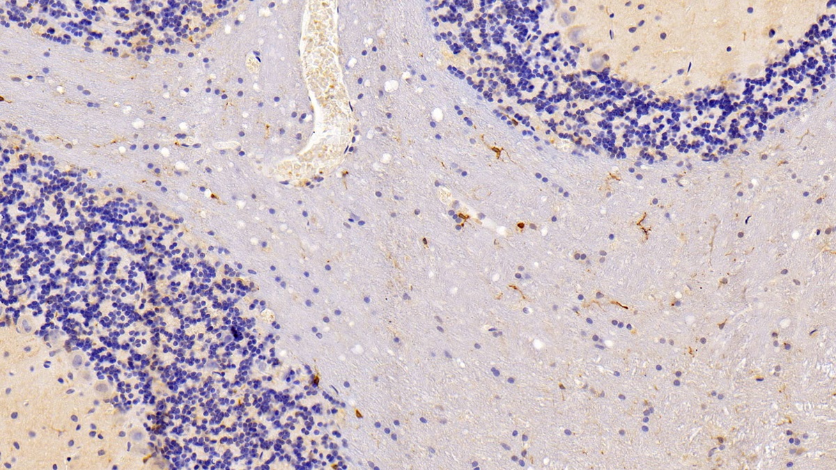 Polyclonal Antibody to Ionized Calcium-binding Adapter Molecule 1 (IBA1)