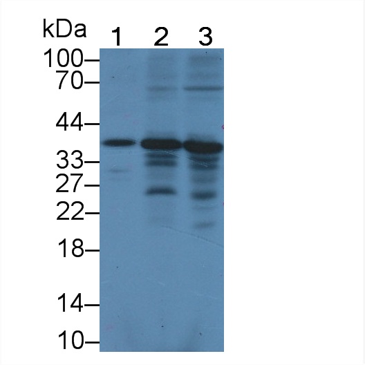 Polyclonal Antibody to Aryl Hydrocarbon Receptor Interacting Protein (AIP)