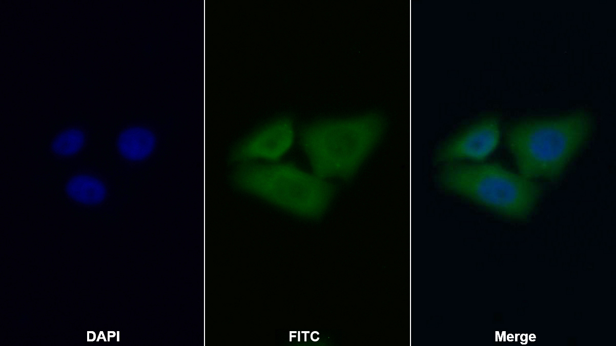 Polyclonal Antibody to Aryl Hydrocarbon Receptor Interacting Protein (AIP)