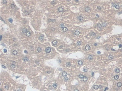 Polyclonal Antibody to Adenylate Kinase 2 (AK2)